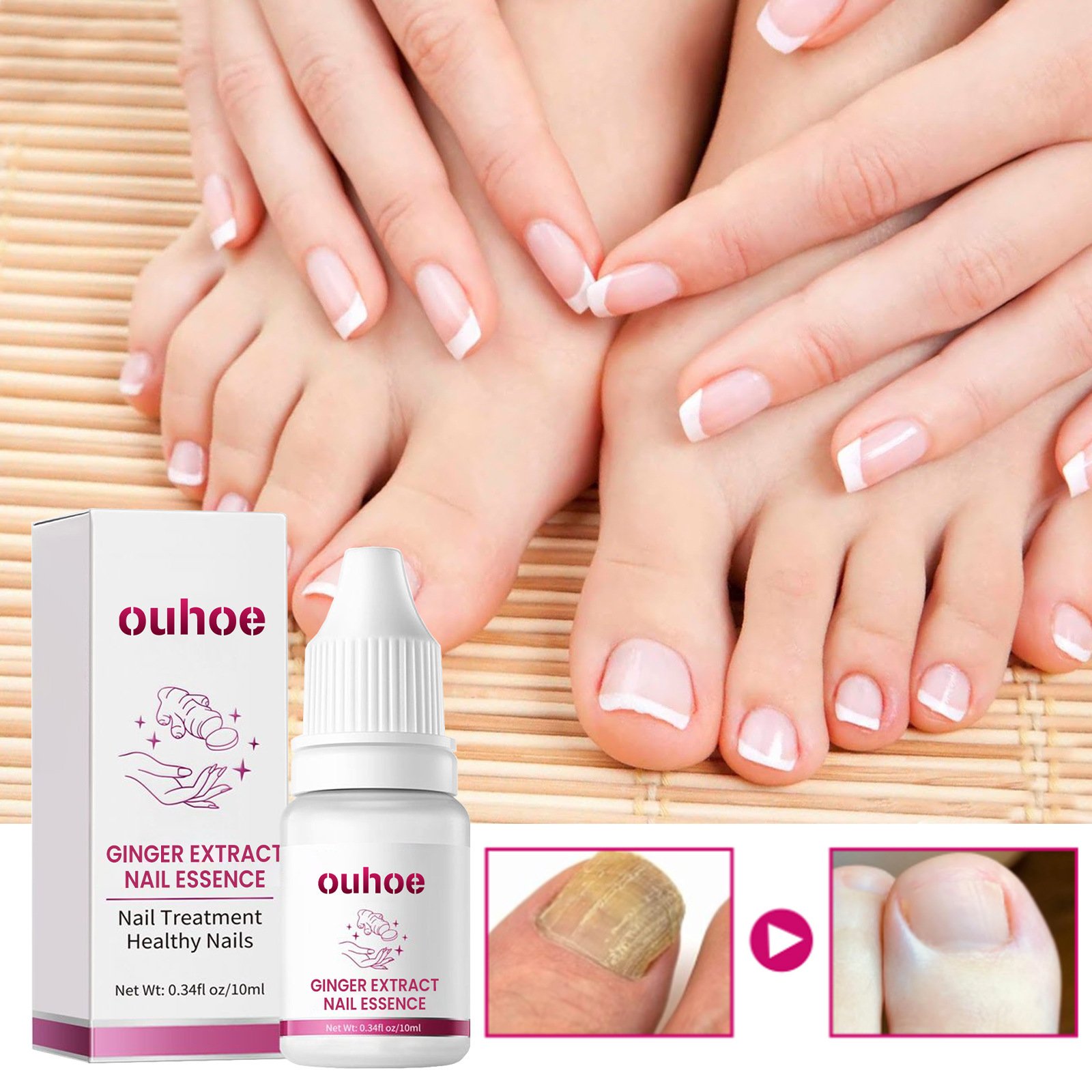 Moisturizing And Nourishing Nail Ginger Care Essence